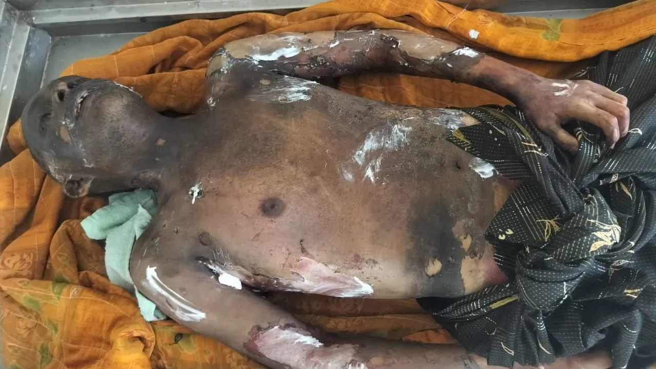 అనారోగ్యంతో వ్యక్తి ఆత్మహత్య  