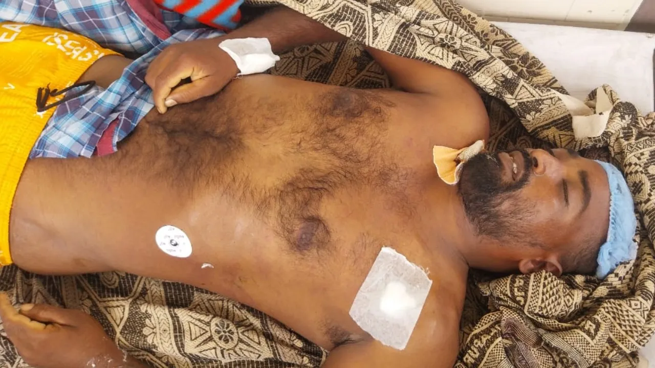 పాముకాటుకు భవన నిర్మాణ కార్మికుడు మృతి