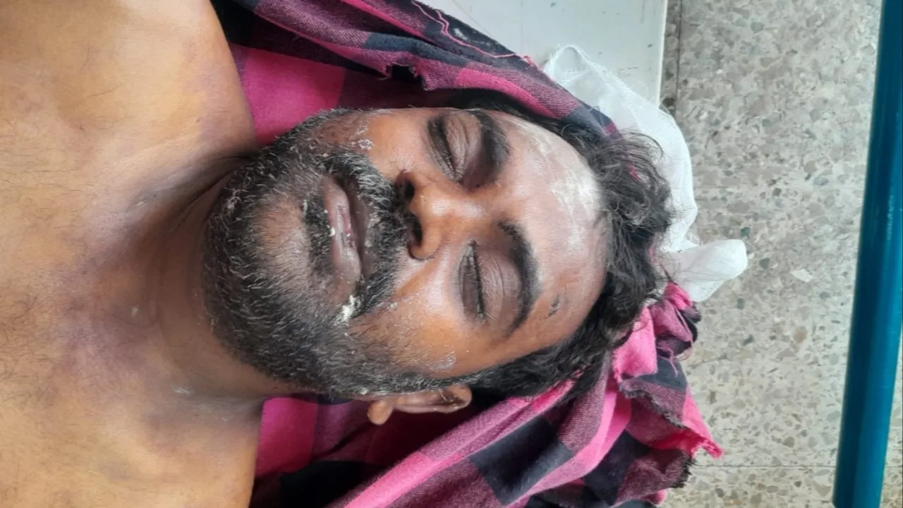 అడవి పంది అడ్డం రావడంతో బైక్ నుండి కింద పడి తీవ్ర గాయాలై వ్యక్త వ్యక్తి మృతి...